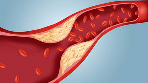 4. Giảm lượng cholesterol và lượng đường trong máu
