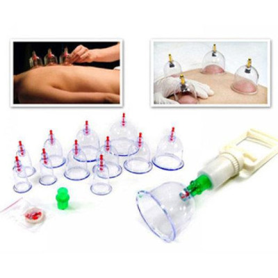 Bộ giác hơi 12 món không dùng lửa (cao cấp) Giúp giảm các chứng đau lưng; đau đầu; cảm cúm; nhức mỏi