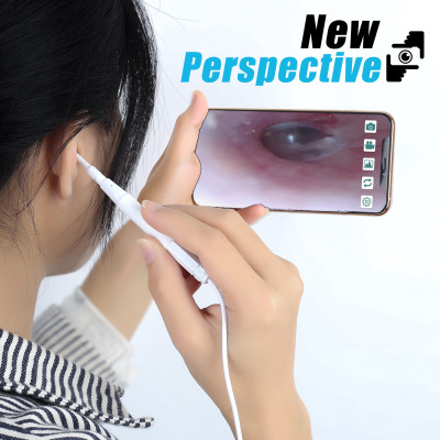 ROGTZ - Camera Nội Soi Tai Mũi Họng AN103 Hình Ảnh HD Sắc Nét Tích Hợp Đèn LED Tiện Ích 3 Trong 1 USB Micro USB TypeC Kết Nối Dễ Dàng Android Window Bộ Đầu Lấy Ráy Tai Sức Khỏe Tai Mũi Họng Tại Nhà Trẻ Em  Phụ Huynh - Hàng Chính Hãng