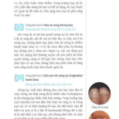 Trang Điểm Móng - Cách Thể Hiện Bản Thân Của Những Cô Gái Tự Tin