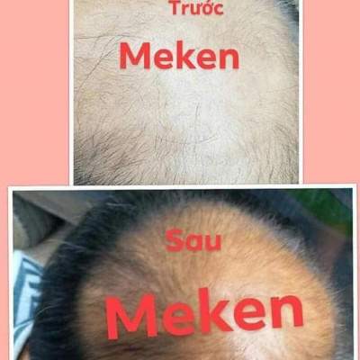 TINH CHẤT GỘI ĐẦU THẢO MỘC MẸ KEN-Chai 250ml