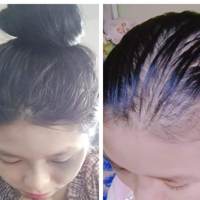 Bộ ba dầu gội thảo mộc Mẹ Ken chai lớn 500ml tặng 1 chai gội nhỏ 250ml