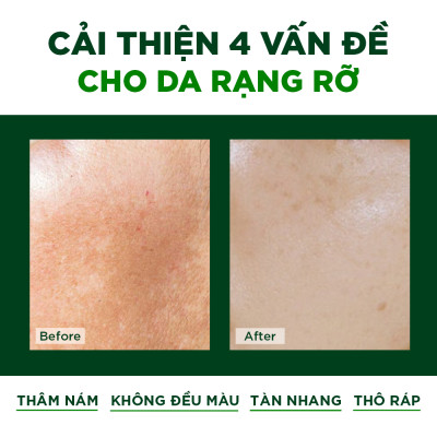 Combo 3 Viên Uống Đẹp Da Oribe Hỗ Trợ Sáng Da Mờ Thâm Nám Hộp 30 viên
