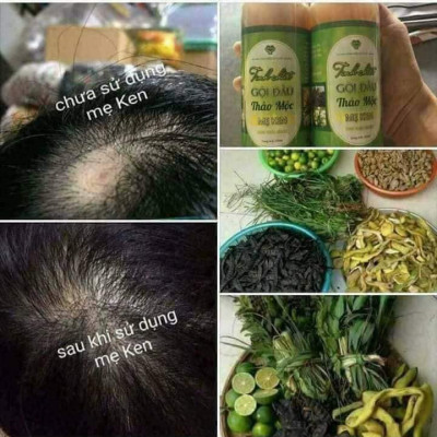 TINH CHẤT GỘI ĐẦU THẢO MỘC MẸ KEN-Chai 250ml