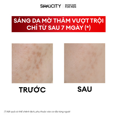 Bộ serum Men Stay Simplicity giảm mụn, làm dịu, sáng da, mờ thâm, thu nhỏ lỗ chân lông cho nam Niacinamide 5% + Zinc PCA 1% 2x30ml