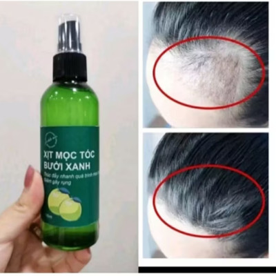 CHAI TINH DẦU BƯỞI THẢO MỘC XỊT KÍCH THÍCH MỘC TÓC CAO CẤP CHO MỌI NGƯỜI