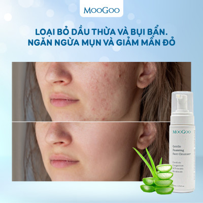 Sữa rửa mặt tạo bọt chiết xuất đu đủ cho da nhạy cảm, da mụn ko SLS, Sulffate Moogoo