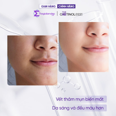 Combo kem dưỡng sáng mờ thâm cho da dầu mụn The Gentinol 0221