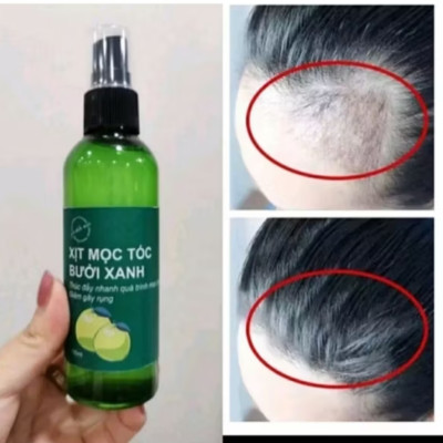 1 CHAI TINH DẦU THẢO MỘC XỊT KÍCH THÍCH MỘC TÓC CAO CẤP CHO MỌI GIA ĐÌNH