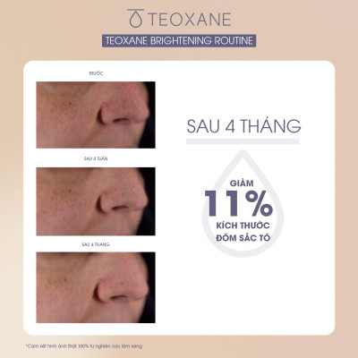 Combo Serum làm sáng, săn chắc da Teoxane RHA Vit C Serum + Kem chống Nắng Teoxane Advanced Perfecting Shield SPF 50+