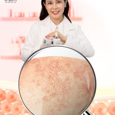 [Mẫu cũ] Bộ 2 sản phẩm Trắng Da Ngừa Nám KN Beauty: Kem dưỡng 10g + Serum 30ml