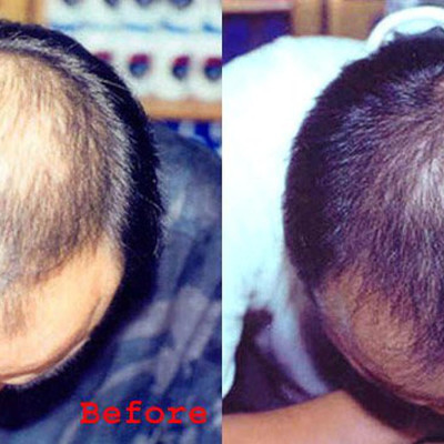 Biotin mọc tóc Natrol Beauty Mỹ hỗ trợ tóc mọc nhanh hơn, dày hơn, cho mái tóc khỏe mạnh, làn da rạng rỡ và móng tay chắc khỏe - QuaTangMe Extaste