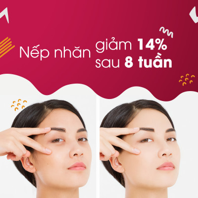 Viên uống đẹp da Collagen Sắc Ngọc Khang 120 viên thế hệ mới giúp sáng da, giảm nếp nhăn - đốm nâu, nuôi dưỡng và làm đẹp da , tóc, móng