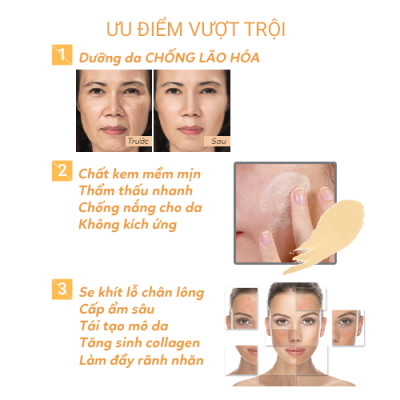 Kem Dưỡng Trắng Da Collagen Ngừa Lão Hóa Zoley 10g