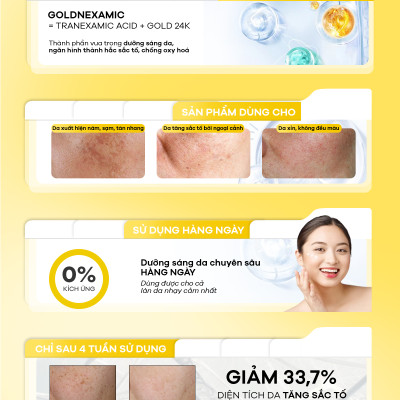 Serum mờ thâm nám, đều màu da Anodin Goldnexamic 10X Hàn Quốc 30ml