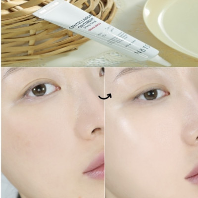 [Date 27/11/2025] Kem Phục Hồi Tái Tạo Da NoTS CENTELLASCAR OINTMENT [Ylang-Ylang]