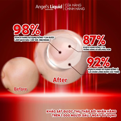 Nước Thần Dưỡng Trắng Da Cân Bằng Độ Ẩm Angel