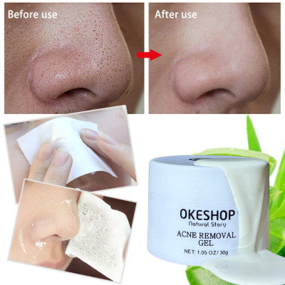 Giấy Lột Mụn Cám - Mụn Đầu Đen OKESHOP - Giải Pháp Cùng Gel Lột Mụn OKESHOP 600 tờ