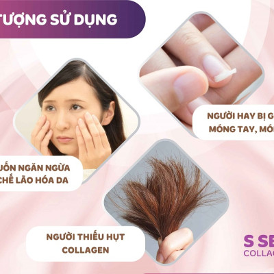 [Mua 1 Tặng 1] Nước Uống Đẹp Da S Select Collagen Drink Collagen Peptide, Chống Lão Hóa Da, Khỏe Tóc & Móng (Hộp 10 lọ)