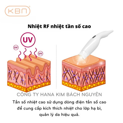 Máy Nâng Cơ POLKA RF Hàn Quốc Xóa Nhăn, Trẻ Hóa Da