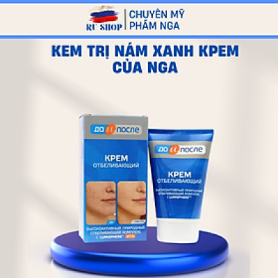 Kem giảm nám xanh Kpem Before and After до и после Nga - Kem giảm nám trắng da Nga Kpem