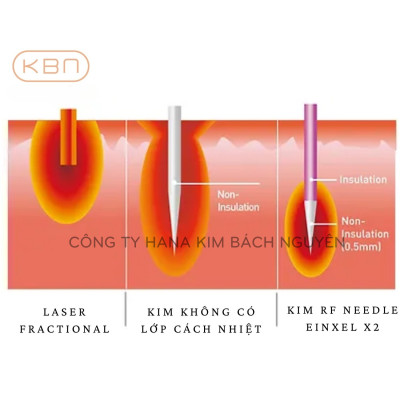 Máy RF Vi Điểm EINXEL X2 Giảm Nếp Nhăn, Thu Nhỏ Lỗ Chân Lông, Vết Rạn Da, Trị Sẹo