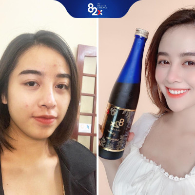 DA TRẮNG KHÔNG BẮT NẮNG Combo 3 Chai: PLACENTA + SAKURA PLACENTA + SAKURA COLLAGEN Nước Uống Đẹp Da Từ Nhật Bản Số 1 VN