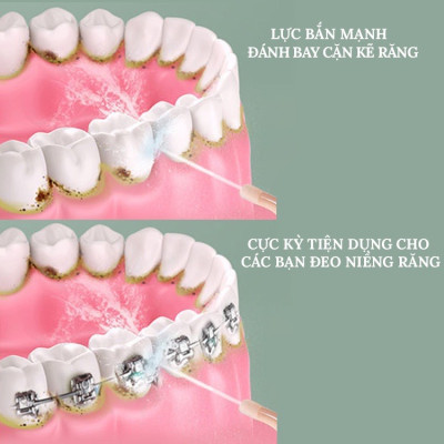 Máy Tăm Nước Oral Irrigator Thế Hệ Mới - Dùng Pin Sạc, Công Nghệ Châu Âu