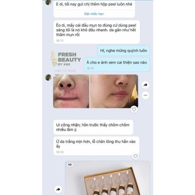 Set 5 thay da sinh học Pime Sinbi Peel tái tạo, hỗ trợ giảm thâm mụn, sẹo, nám, tàn nhang 10ml