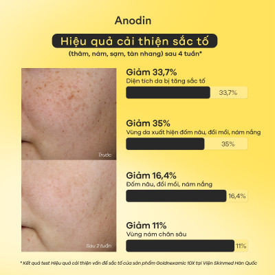 Serum mờ thâm nám, đều màu da Anodin Goldnexamic 10X Hàn Quốc 30ml