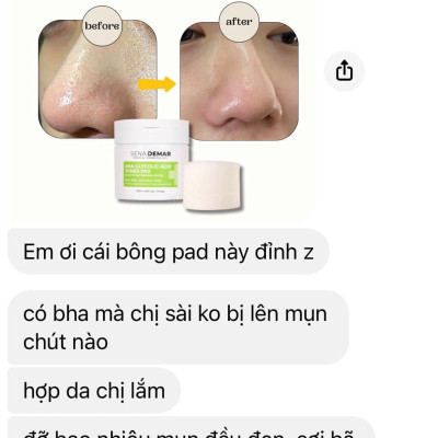 Toner Pad SENADEMAR giúp tẩy tế bào chết giúp da sáng mịn từ Hàn Quốc 150ml/70 miếng hạn 2027