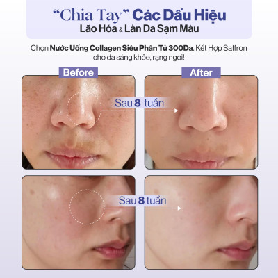 NƯỚC UỐNG COLLAGEN GILAA SIÊU PHÂN TỬ 300DA KẾT HỢP SAFFRON TRẺ HÓA TRẮNG KHỎE DA (20g x 15 gói)
