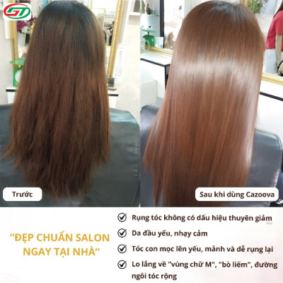 Serum dầu dưỡng hỗ trợ giảm gãy rụng, hỗ trợ mọc tóc cho tóc thưa yếu – phù hợp mẹ bầu sau sinh Cazoova 50ml