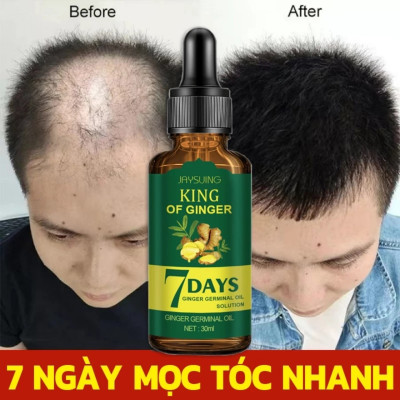 Tinh Dầu Xịt Mọc Tóc EELHOE: Tinh Chất Thiên Nhiên Từ Nhân Sâm Giup Mọc Tóc Hiệu Quả Chỉ Sau 7 Ngày