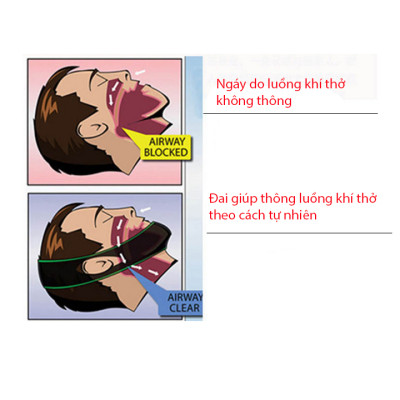 Đai nẹp cằm chống ngáy khi ngủ Stop Snoring belt Aolikes YE-2107