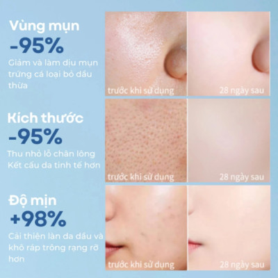 Tẩy trang Compliment Micellar water 400ml tẩy trang mặt mắt môi, sử dụng được cho cả da nhạy cảm