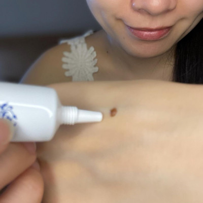 GEL HỖ TRỢ XOÁ MỤN THỊT CỔ BAN ĐÊM TSUBUPORON NIGHT PACK - XÓA MỤN THỊT VÙNG CỔ NHẬT BẢN