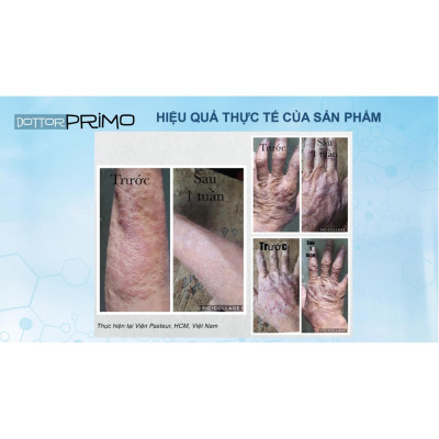 Kem Bôi Viêm Da Cơ Địa, Chàm Da, Eczema, Da Nứt Nẻ DottorPrimo Skin Repair - Giảm Mẩn Ngứa, Thô Ráp (Tuýp 20-50ml)
