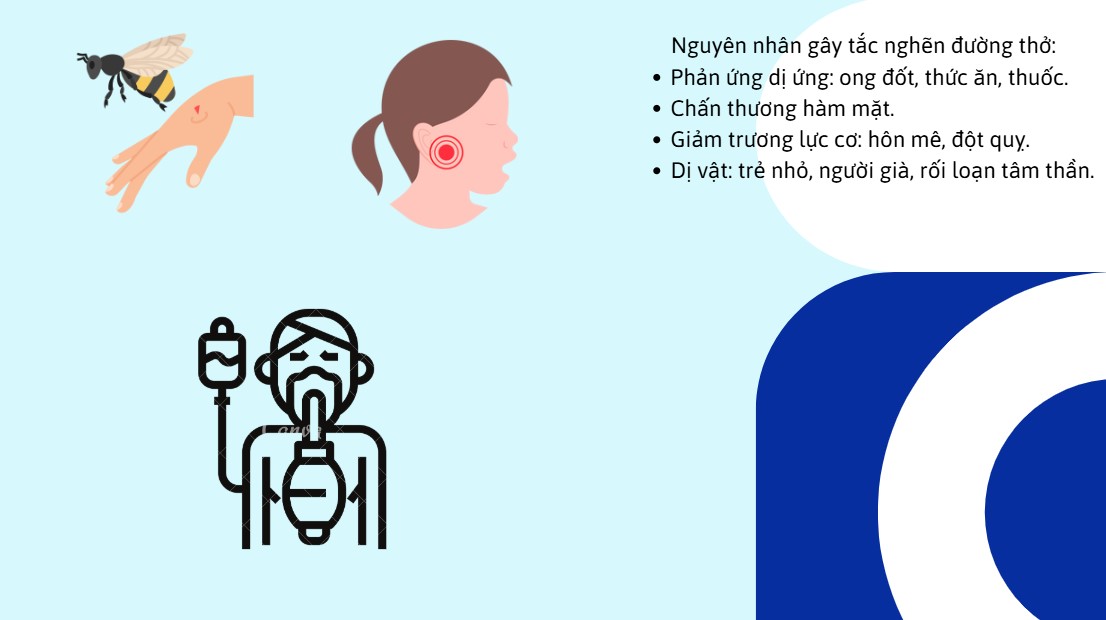 2. Nguyên Nhân Gây Tắc Nghẽn Đường Thở
