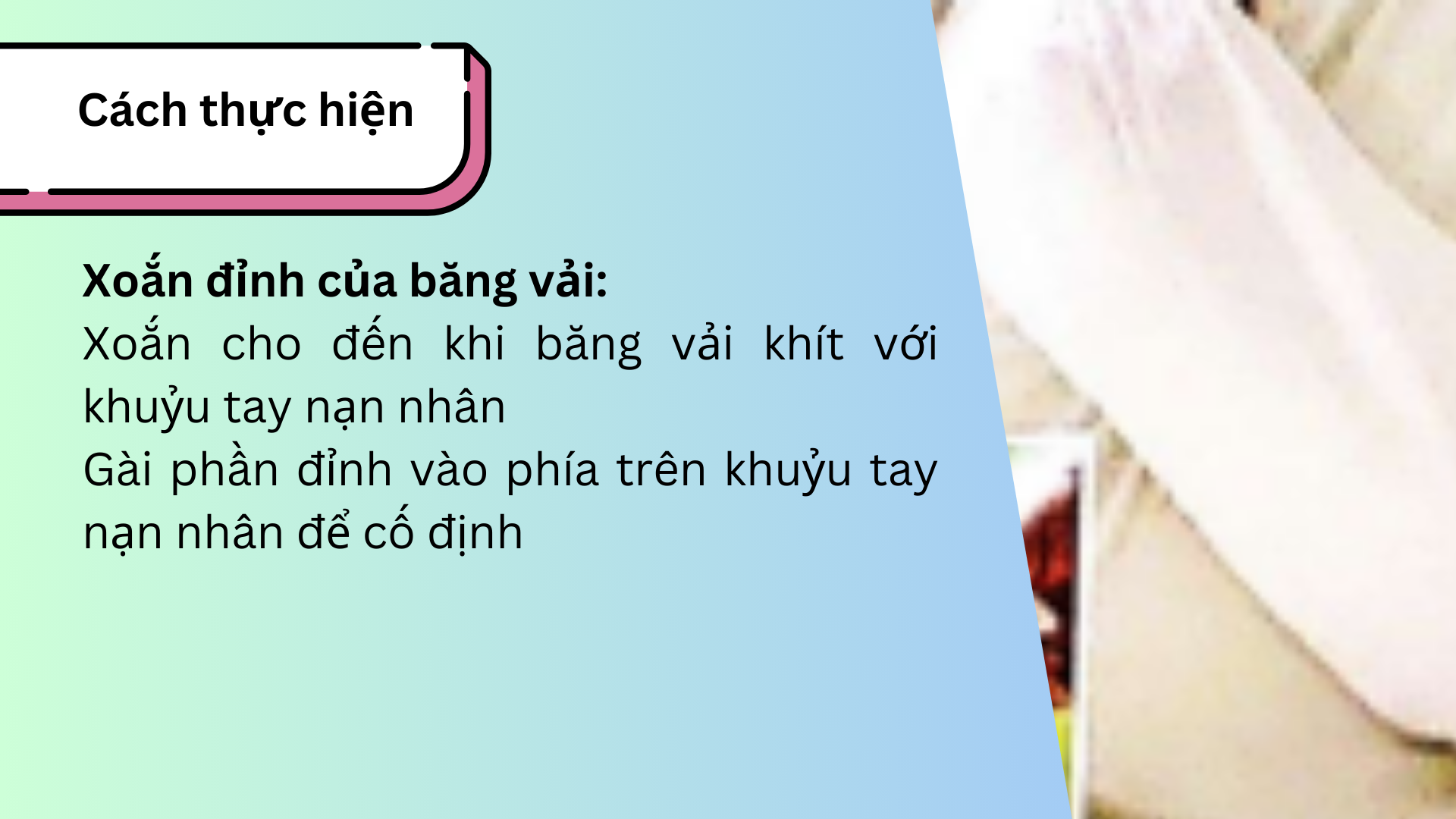 Xoắn đỉnh của băng vải
