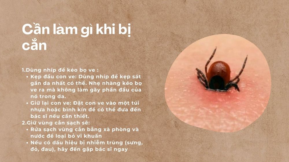 2. Cần làm gì khi bị cắn