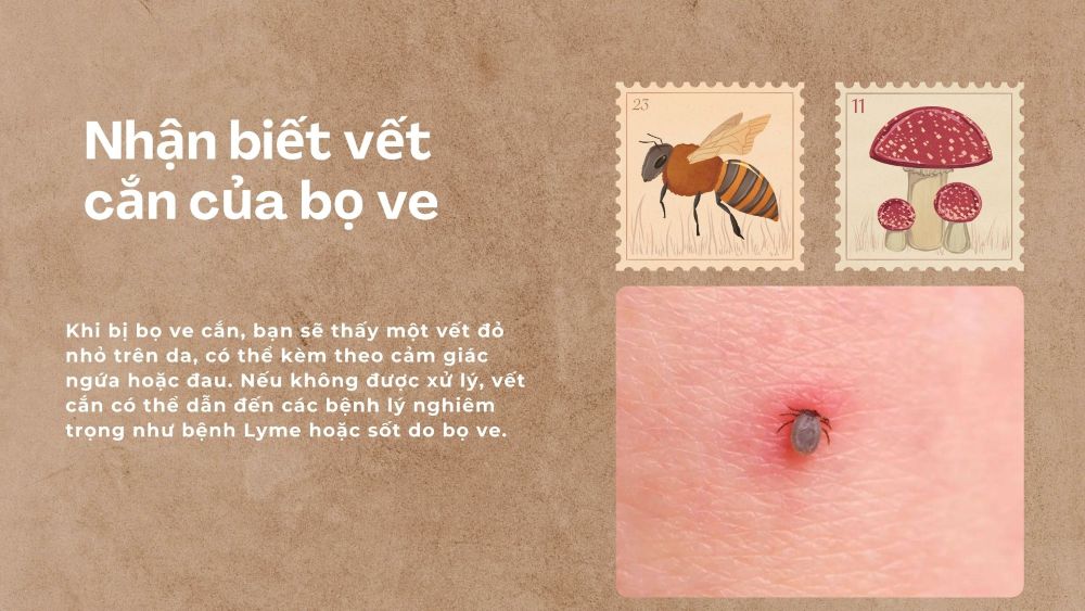 1. Nhận biết vết cắn của bọ ve