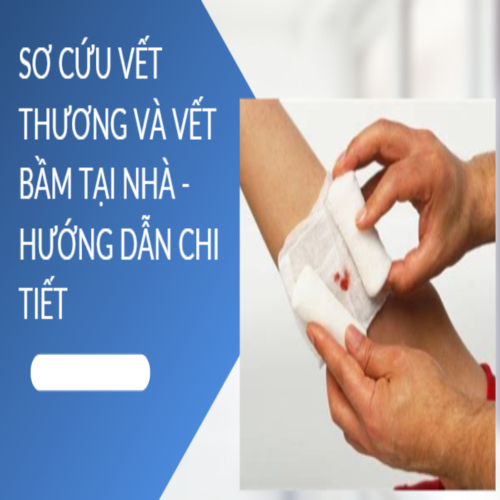 Sơ Cứu Vết Thương Và Vết Bầm Tại Nhà - Hướng Dẫn Chi Tiết