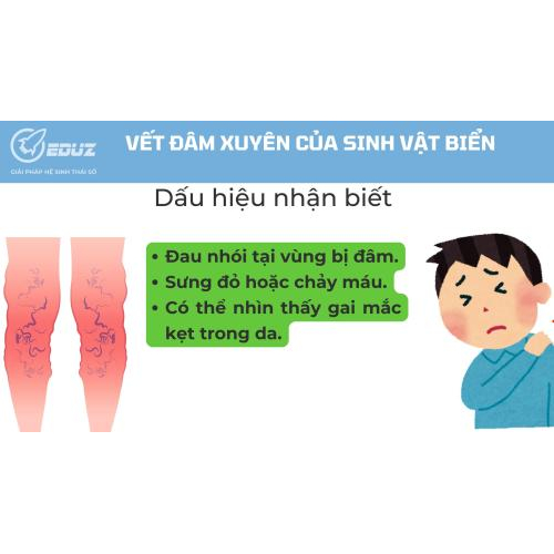 2. Dấu hiệu nhận biết