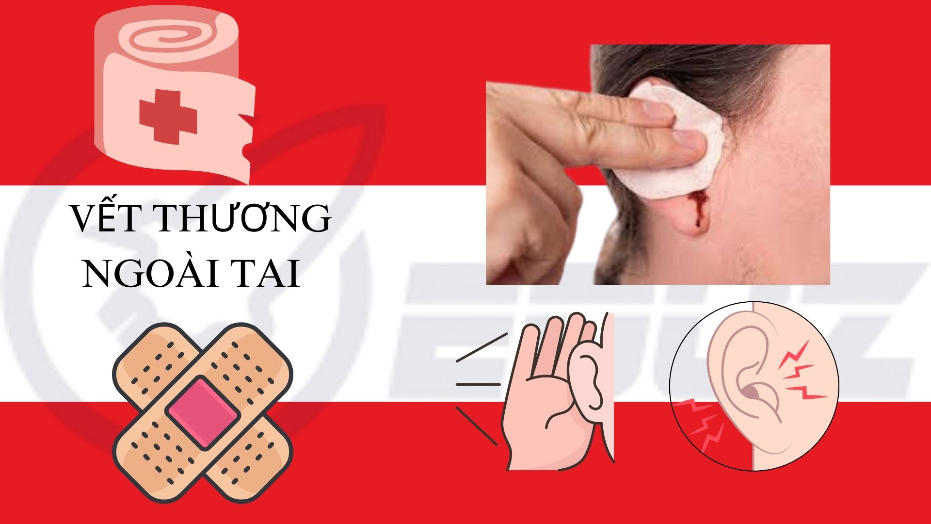 Vết thương ngoài tai