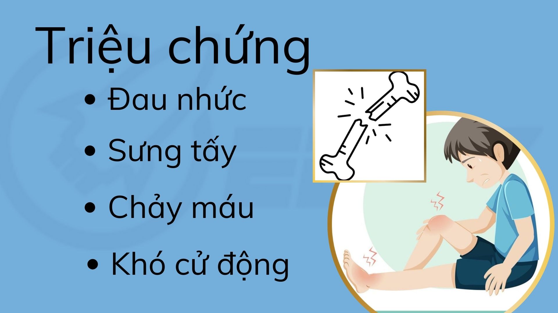 2.Triệu chứng