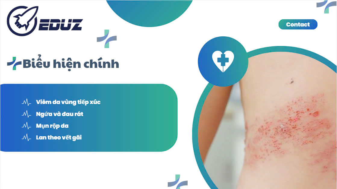 3. Triệu chứng và chuẩn đoán