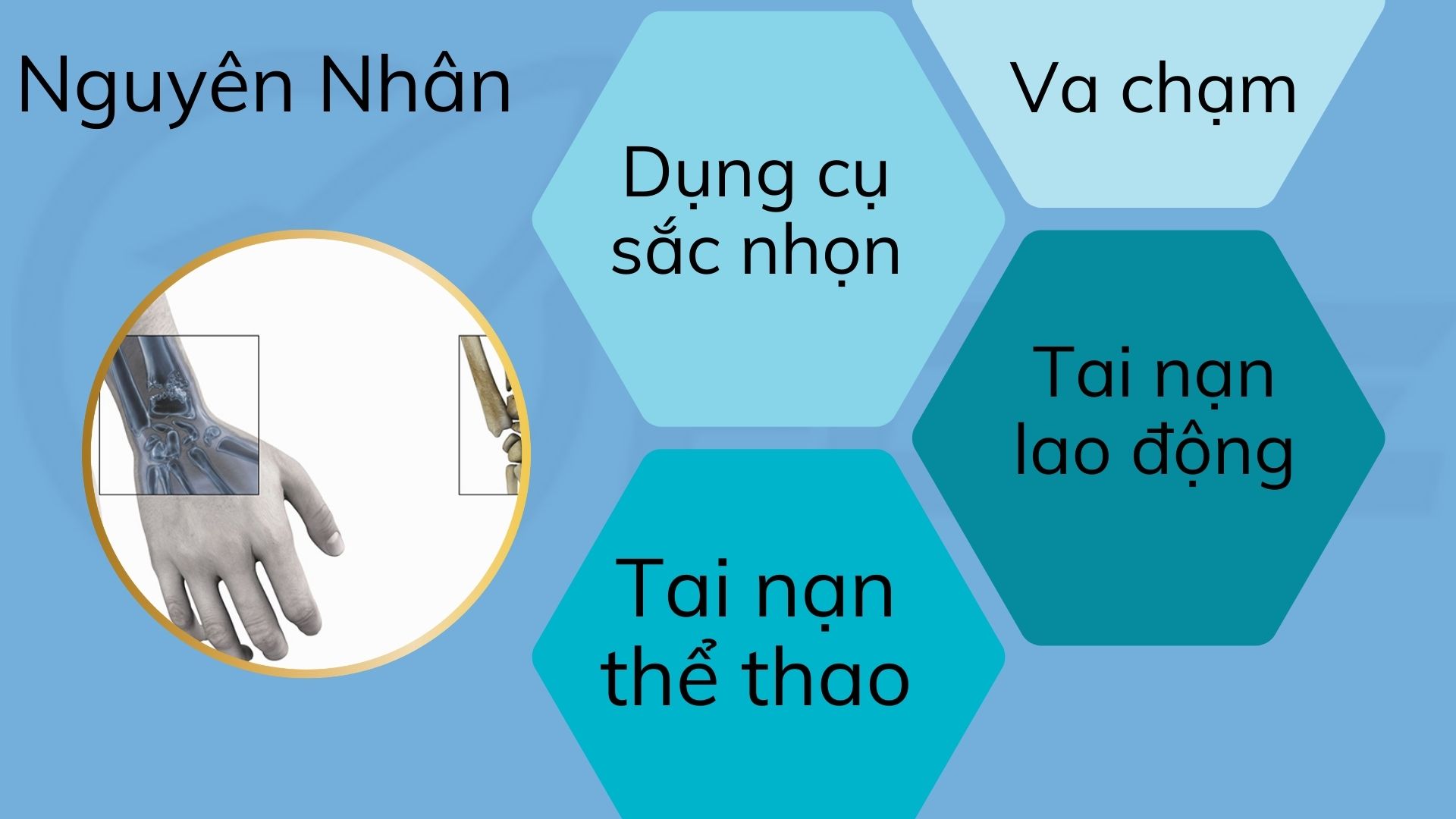 3.Nguyên nhân