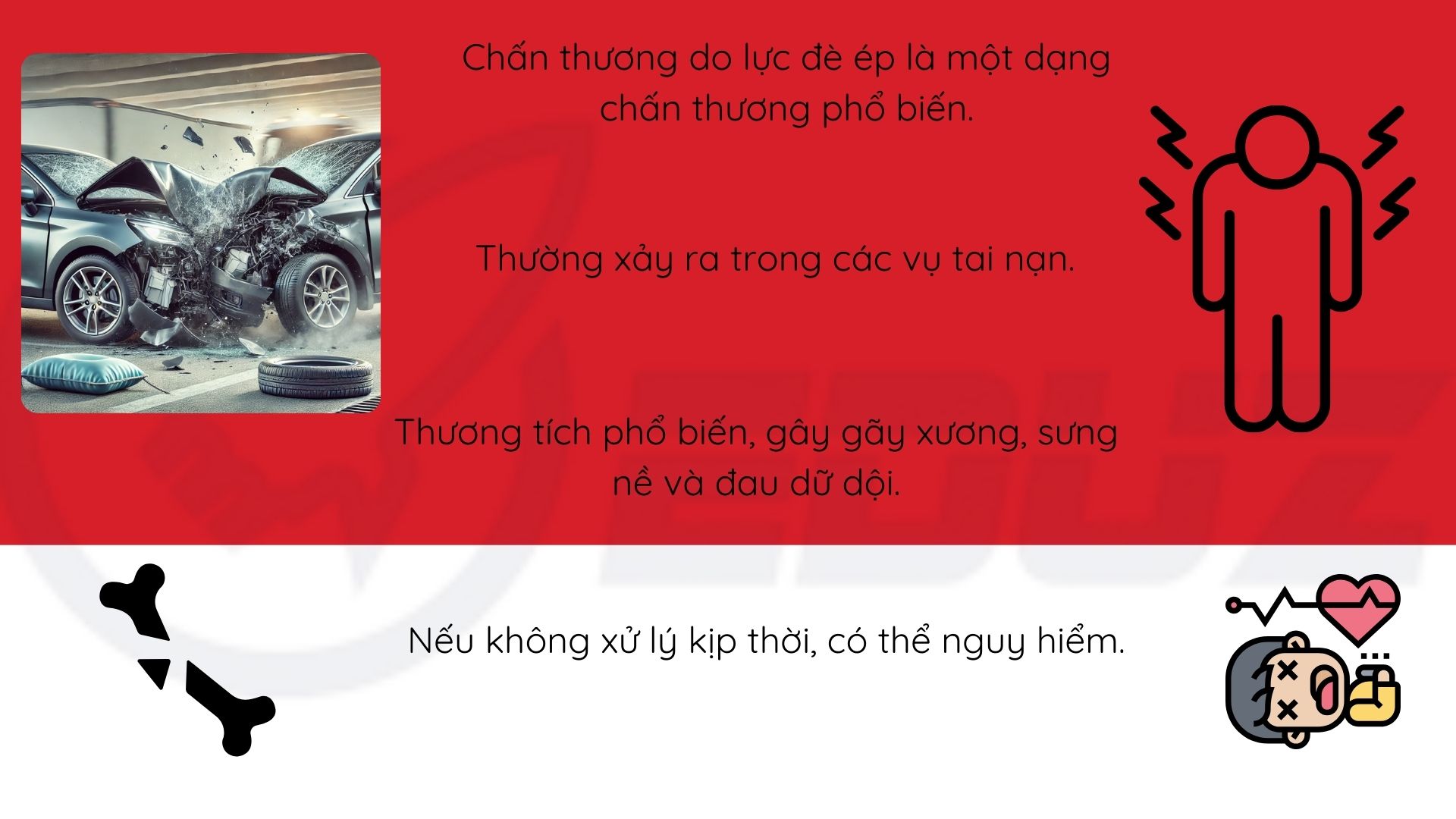 1.Thương tích do lực đè ép là?