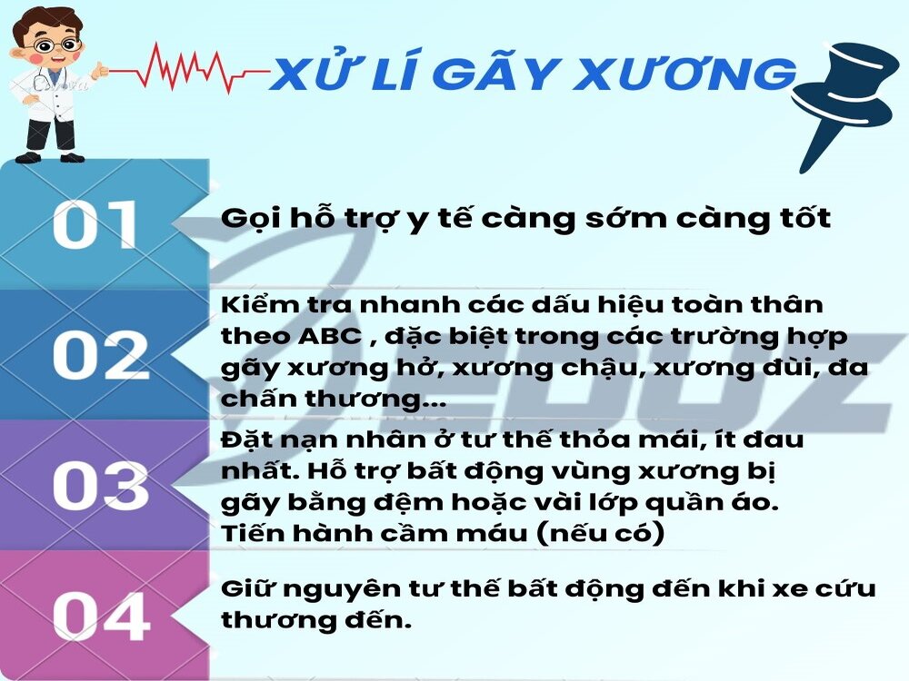 4. Xử lý khi bị gãy xương